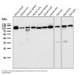 Anti-FGFR3 Rabbit Monoclonal Antibody