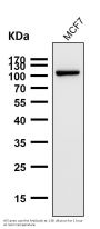 Anti-FGFR3 Rabbit Monoclonal Antibody