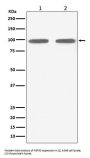 Anti-FGFR3 Rabbit Monoclonal Antibody