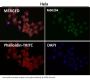 Anti-Ran Monoclonal Antibody