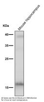 Anti-FGF1 Rabbit Monoclonal Antibody