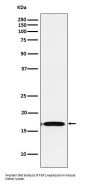 Anti-FGF1 Rabbit Monoclonal Antibody