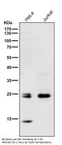 Anti-Rho A + B + C Rabbit Monoclonal Antibody