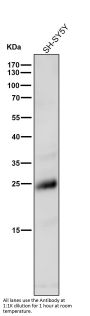 Anti-Rho RHOA Rabbit Monoclonal Antibody