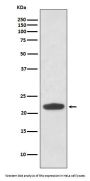 Anti-Rho RHOA Rabbit Monoclonal Antibody
