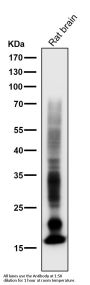 Anti-Myelin Basic Protein MBP Rabbit Monoclonal Antibody