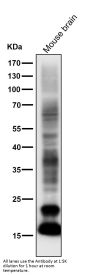 Anti-Myelin Basic Protein MBP Rabbit Monoclonal Antibody
