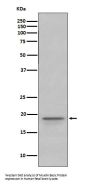 Anti-Myelin Basic Protein MBP Rabbit Monoclonal Antibody