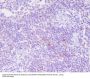 Anti-CD25 IL2RA Monoclonal Antibody