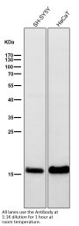 Anti-Alpha Synuclein SNCA Rabbit Monoclonal Antibody