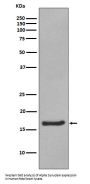Anti-Alpha Synuclein SNCA Rabbit Monoclonal Antibody