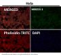 Anti-Alpha Synuclein SNCA Rabbit Monoclonal Antibody