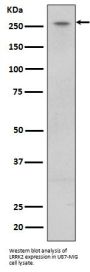Anti-LRRK2 Rabbit Monoclonal Antibody