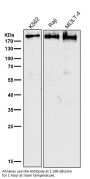 Anti-BRG1 Rabbit Monoclonal Antibody