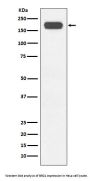 Anti-BRG1 Rabbit Monoclonal Antibody