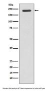 Anti-Tuberin TSC2 Rabbit Monoclonal Antibody