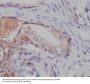 Anti-Tuberin TSC2 Rabbit Monoclonal Antibody