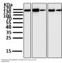 Anti-FGFR2 Rabbit Monoclonal Antibody
