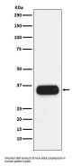 Anti-HLA-DQA1 Monoclonal Antibody
