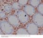 Anti-Vimentin Rabbit Monoclonal Antibody