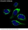 Anti-Vimentin Rabbit Monoclonal Antibody