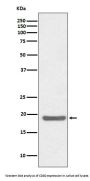 Anti-SOD1/Cu Zn Sod Rabbit Monoclonal Antibody