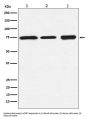 Anti-BTK Rabbit Monoclonal Antibody