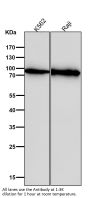 Anti-BTK Rabbit Monoclonal Antibody