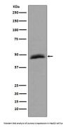 Anti-Aurora A AURKA Rabbit Monoclonal Antibody
