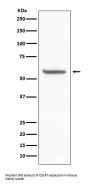 Anti-CD147 BSG Rabbit Monoclonal Antibody