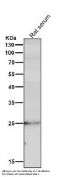 Anti-C Reactive Protein CRP Rabbit Monoclonal Antibody