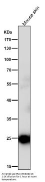 Anti-C Reactive Protein CRP Rabbit Monoclonal Antibody