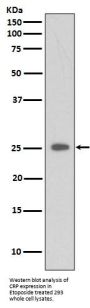 Anti-C Reactive Protein CRP Rabbit Monoclonal Antibody