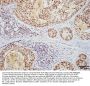 Anti-HSF1 Monoclonal Antibody