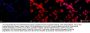Anti-HSF1 Monoclonal Antibody
