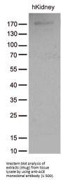 Anti-Angiotensin Converting Enzyme 1 (ACE) Mouse Monoclonal Antibody [Clone ID: OTI2C8]