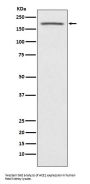 Anti-ACE1 Monoclonal Antibody