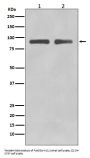 Anti-FoxO3a Rabbit Monoclonal Antibody