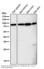 Anti-FoxO3a Rabbit Monoclonal Antibody