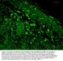 Anti-HO-1 Monoclonal Antibody