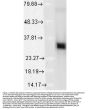 Anti-HO-1 Monoclonal Antibody