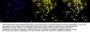 Anti-HO-1 Monoclonal Antibody