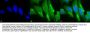 Anti-HO-1 Monoclonal Antibody