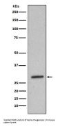 Anti-Heme Oxygenase 1 HMOX1 Rabbit Monoclonal Antibody