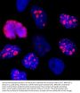 Anti-Human Ki-67 Monoclonal Antibody