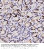 Anti-Ki-67 MKI67 Antibody