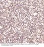 Anti-Ki67 MKI67 Rabbit Monoclonal Antibody