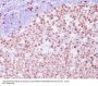Anti-Ki67 MKI67 Rabbit Monoclonal Antibody