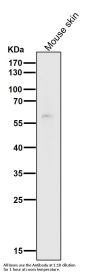 Anti-HDAC1 Rabbit Monoclonal Antibody