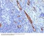 Anti-von Willebrand Factor / Factor VIII Related-Ag (Endothelial Marker) VWF Monoclonal Antibody